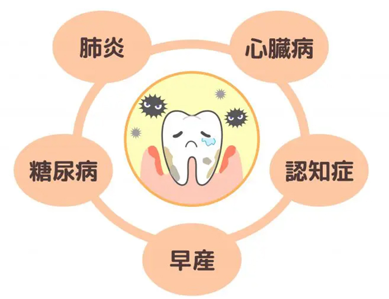 西葛西の歯医者、まさき歯科クリニックの予防歯科